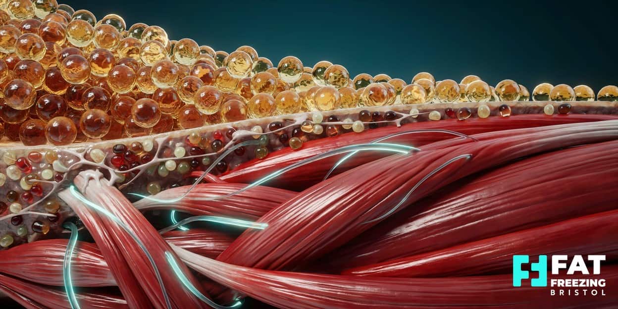A 3D anatomical render of a thinning golden fat layer above a thickening, glowing layer of striated muscle fibres threaded with electromagnetic light arcs, showing how fat freezing and EMSculpt target different tissue layers